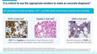 Systemic Mastocytosis Overview of Disease and Diagnosis for Pathologists [upl. by Pedroza]