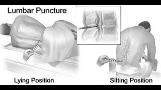 Mnemonics to remember structures pierced during Lumbar Puncture [upl. by Fairley]