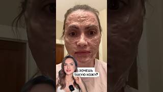 ❌ЗОМБИ МАСКА ОТ ЧЕРНЫХ ТОЧЕК И МОРЩИН😱маскаотморщин маскаотпрыщей маскадлялица кремдлялица [upl. by Yukio]