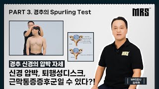 Part 3 경추의 Spurling test • MRS 재활트레이너를 위한 【ONE STOP EDUCATION】 [upl. by Reni191]