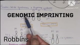 Genomic imprinting PraderWilli and Angelman syndrome Robbins हिंदी [upl. by Eninotna]