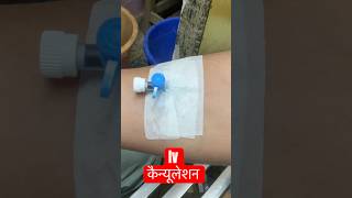 intravenous cannulation ivcannulation medicalequipment SMpharmacy subscribe [upl. by Cecily]