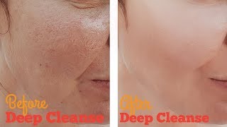 How to Deep Clean Facial Pores with Home Remedies [upl. by Ordisi]