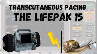 Quick Review LIFEPAK 15 PACING [upl. by Atinev]