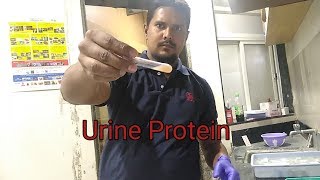 Urine Protein Test Procedure [upl. by Piegari]