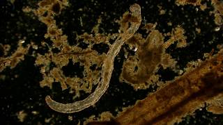 🔬 Aeolosomatidae cariegatum under a dark field microscope  life in a drop of water 4K [upl. by Itteb]