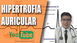 HIPERTROFIA DILATACIÓN Y CRECIMIENTOS DE LAS AURÍCULAS CARDÍACAS EKG [upl. by Nedrob334]