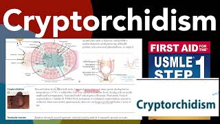 Cryptorchidism in HindiUrdu by first aid for USMLE step 1 [upl. by Latashia]