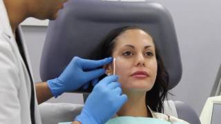 Facial Sculpting using Botox and Dermal Fillers Juvederm Voluma by Dr Shaun Patel in Miami [upl. by Gambrill]