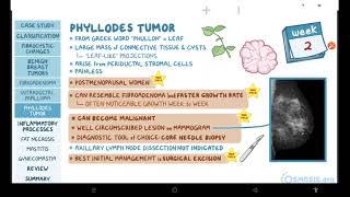 Benign breast conditions  pathology review  Osmosis [upl. by Obie278]