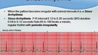 NCLEX Tutor EKG strips for the NCLEX amp beginners [upl. by Arotal]