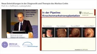 Neue Entwicklungen in der Diagnostik und Therapie des Morbus Crohn [upl. by Jarred]