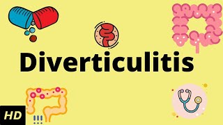 Diverticulitis Causes SIgns and Symptoms Diagnosis and Treatment [upl. by Sadye]