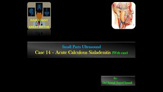 Ultrasound Case 14  Acute Calculous Sialadenitis Web case [upl. by Eeryn]