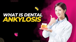 What is Dental Ankylosis 5 Symptoms You Should Know [upl. by Ydnelg]