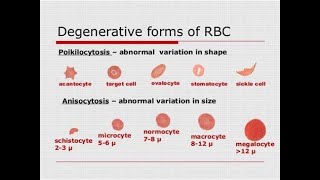 Variation in the shape of red blood cells Crenation spherocytosis Elliptocytosis sickle cell Po [upl. by Grimbly]