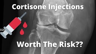 Cortisone Injection In The Knee Is It Safe [upl. by Pru]