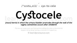 Cystocele pronunciation and definition [upl. by Mariam]