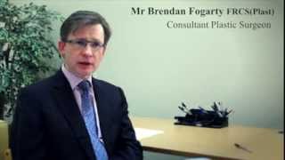 Mr Brendan Fogarty  Cosmetic Surgery [upl. by Iur734]