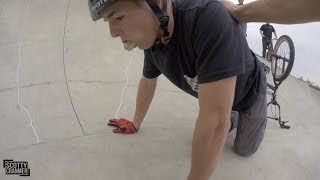 MATTY SLAMS HARD AT THE SKATEPARK [upl. by Himelman]