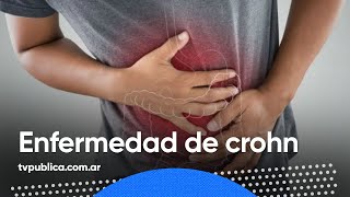 Diagnóstico y tratamiento de la enfermedad de Crohn – En Casa Salud [upl. by Arinayed]