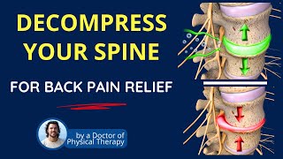 BEST Spinal Decompression Exercises for Back Pain Relief [upl. by Tenej]