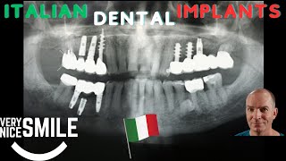 Italian Dental Implants Panoramic Xray [upl. by Pietra]