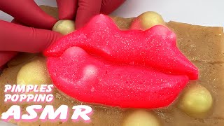 Unwind with a Pimple Popping Livestream on Realistic Silicone Models  Stress Relief Therapy [upl. by Ettezil]