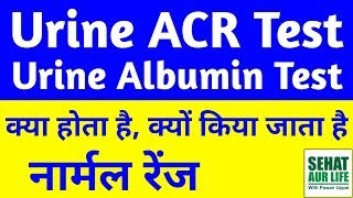 Urine ACR Test in Hindi Urine Albumin Test In Hindi Urine Albumin Normal Range [upl. by Nazay]