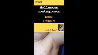 Molluscum contagiosum pour les nuls [upl. by Anelac]