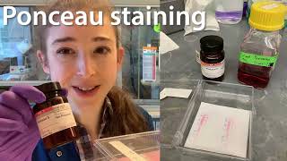 Ponceau staining  what why amp how with some practical tips [upl. by Ahsaelat661]