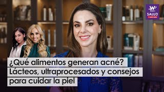 ¿Qué alimentos generan acné Lácteos ultraprocesados y consejos para cuidar la piel [upl. by Turley]