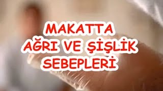 MAKATTA AĞRI VE ŞİŞLİK SEBEPLERİ [upl. by Aborn]