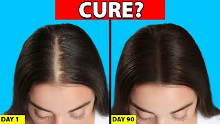 Womens Hair Loss Treatments That ACTUALLY WORK [upl. by Markus]