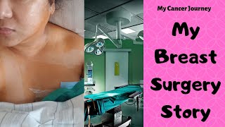 Why I chose a DOUBLE Mastectomy over a Single breastcancer [upl. by Yrevi]