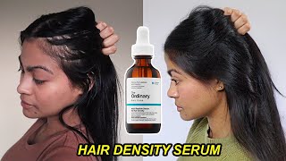 I tried The Ordinary Hair Density Serum for 1 YEAR amp THIS HAPPENED  Before and after results [upl. by Marcin]