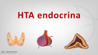 Hipertensión de origen endocrino feocromocitoma e hiperaldosteronismo primario [upl. by Mot250]