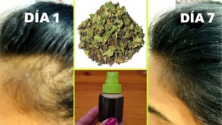 Recupera cabello de LAS SIENES y zonas despobladas con esta receta💪🟢Cabello fortalecido y sin caída [upl. by Pembroke779]