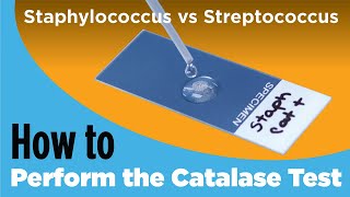 How to Perform the Catalase Test  Staphylococcus vs Streptococcus [upl. by Oremor]