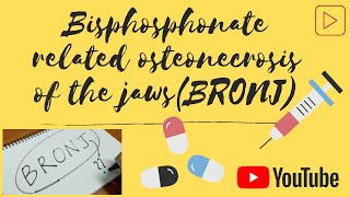 Bisphosphonates Related Osteonecrosis of the Jaws BRONJ [upl. by Ijat307]