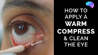 How to Apply a Warm Compress amp Clean the Eye  Eye First Aid  OSCE Guide  UKMLA  CPSA [upl. by Lyris901]