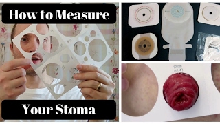 How to Measure Your Stoma OSTOMY TIPS [upl. by Jecho98]