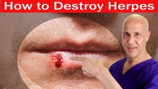 How to Destroy HERPES  Dr Mandell [upl. by Zipnick]