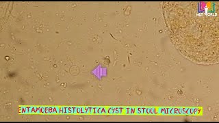 Entamoeba histolytica cyst in stool microscopy [upl. by Smeaj]