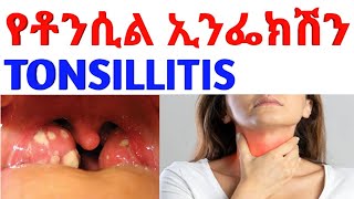 Tonsillitisየቶንሲል ኢንፌክሽን Tonsillitis treatment pharmacy doctor pharmacology antibiotics [upl. by Zuzana]