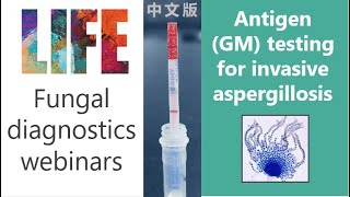 Aspergillus antigen galactomannan  fungal diagnostics webinar with QampA invasive aspergillosis [upl. by Anual]