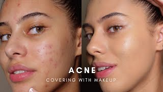 HOW TO COVER ACNE WITH MAKEUP BASE ROUTINE [upl. by Atsyrc]