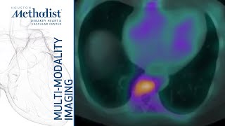 Cardiomyopathies II Restrictive and Inflammatory D Shah MD M Al Mallah MD February 2 2021 [upl. by Eciuqram]