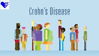 6 Food Facts for Crohns Disease  Healthgrades [upl. by Hubey725]