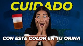 Color de la orina ¿qué dice sobre tu salud [upl. by Nelac]